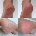 Load image into Gallery viewer, Heel Repair Duo Retail - Lavender
