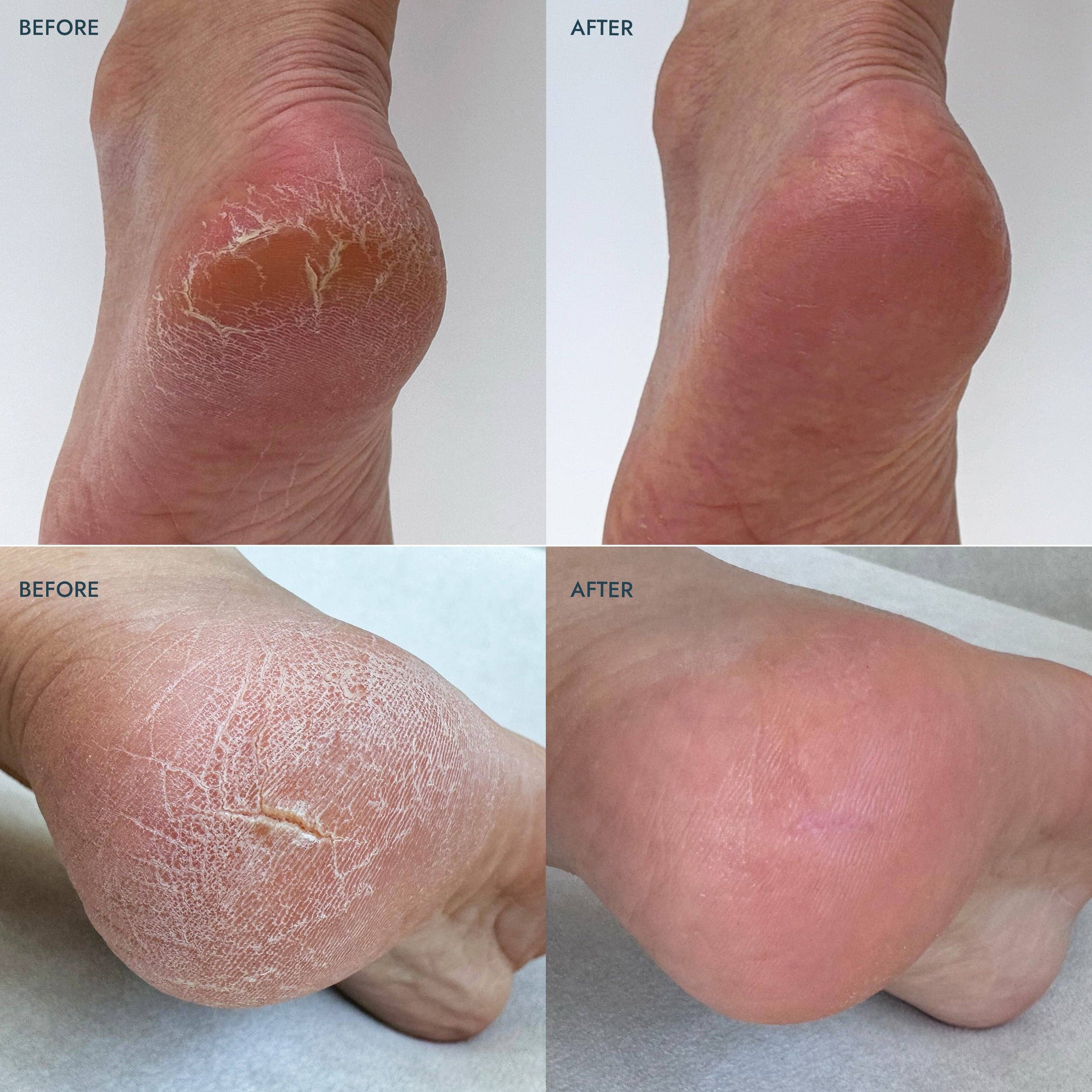 Heel Repair Duo Retail - Lavender